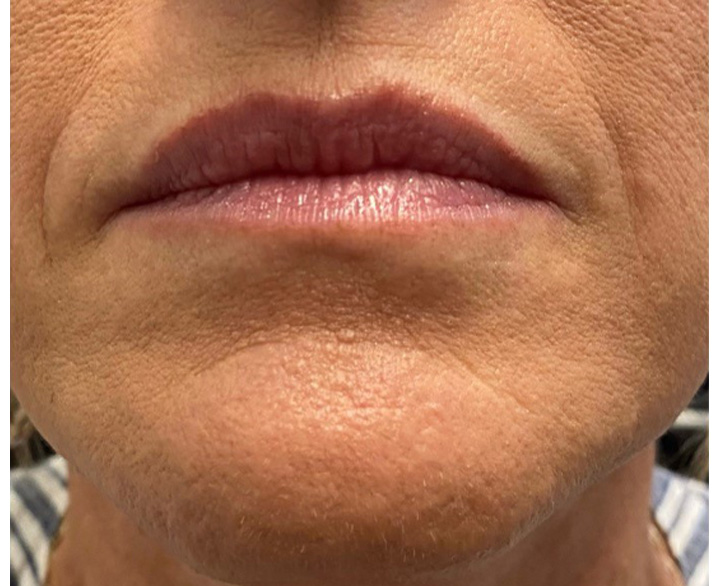 DAO/Mentalis/Jowl After