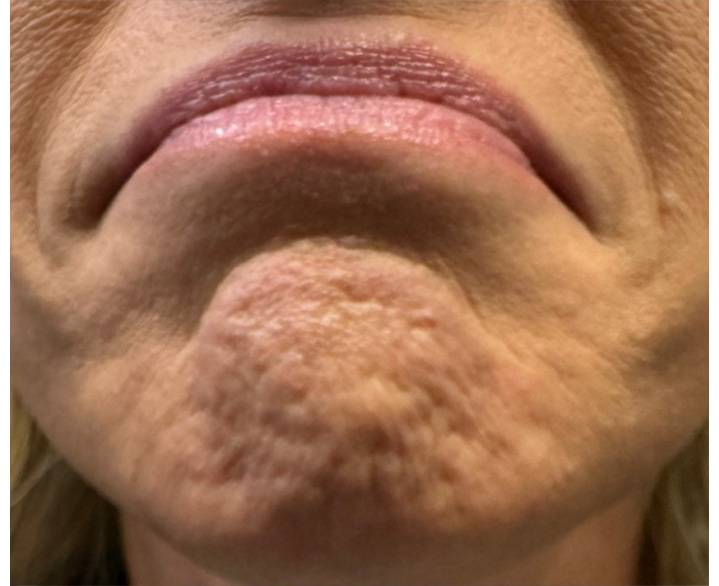DAO/Mentalis/Jowl Before